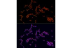 Immunofluorescence analysis of SH-SY5Y cells using SOX11 Rabbit pAb (ABIN7270569) at dilution of 1:100 (40x lens). (SOX11 antibody)