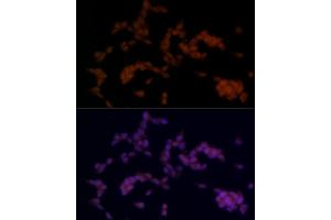 Immunofluorescence analysis of SH-SY5Y cells using SOX11 Rabbit pAb (ABIN7270569) at dilution of 1:100 (40x lens).