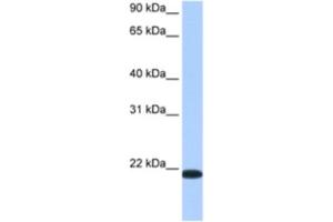 Western Blotting (WB) image for anti-Transmembrane Emp24 Protein Transport Domain Containing 4 (TMED4) antibody (ABIN2462360) (TMED4 antibody)