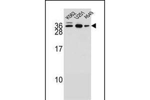 AMN1 Antikörper  (N-Term)