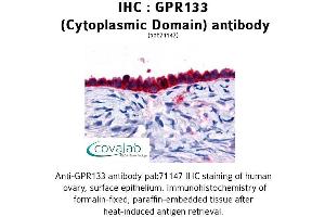 Image no. 1 for anti-G Protein-Coupled Receptor 133 (GPR133) (3rd Cytoplasmic Domain) antibody (ABIN1734933) (G Protein-Coupled Receptor 133 antibody  (3rd Cytoplasmic Domain))