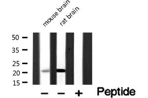 Western blot analysis of CIB2 Antibody expression in Various tissues lysates. (CIB2 antibody  (Internal Region))