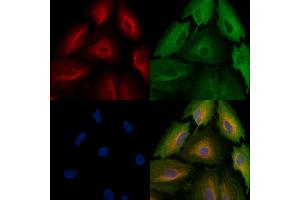 ABIN6257904 and ABIN6274822 staining  cells by IF/ICC. (AARSD1 antibody  (Internal Region))