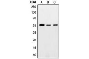 Western blot analysis of SMAD5 expression in HeLa (A), mouse testis (B), PC12 (C) whole cell lysates. (SMAD5 antibody  (Center))