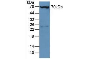 Figure. (Plastin 3 antibody  (AA 5-251))