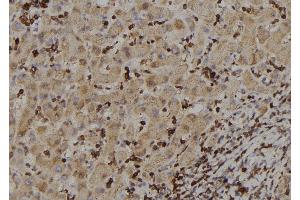 ABIN6273388 at 1/100 staining Human liver tissue by IHC-P. (RIOK2 antibody  (Internal Region))