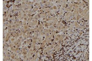 ABIN6273388 at 1/100 staining Human liver tissue by IHC-P. (RIOK2 antibody  (Internal Region))