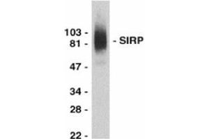 Western blot analysis of SIRP alpha in THP-1 whole cell lysate with this product at 0.