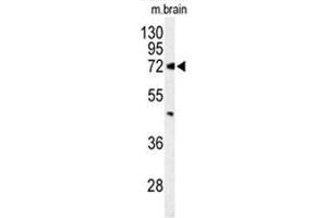 Western blot analysis of ABCD2 Antibody (Center) in mouse brain tissue lysates (35 µg/lane). (Abcd2 antibody  (Middle Region))