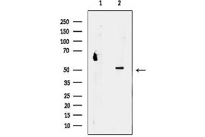 anti-Proteasome (Prosome, Macropain) 26S Subunit, Non-ATPase, 12 (PSMD12) (Internal Region) antibody