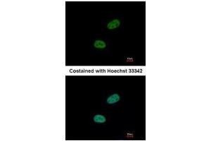 ICC/IF Image Immunofluorescence analysis of paraformaldehyde-fixed HeLa, using SRPX, antibody at 1:500 dilution. (SRPX antibody)