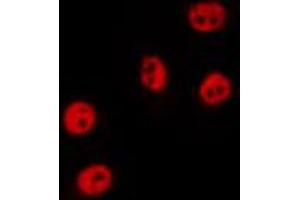 ABIN6274530 staining HepG2 by IF/ICC. (ZAK antibody  (N-Term))