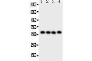 Western Blotting (WB) image for anti-CD34 (CD34) (AA 151-385) antibody (ABIN3043391) (CD34 antibody  (AA 151-385))