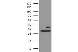 HEK293T cells were transfected with the pCMV6-ENTRY control (Left lane) or pCMV6-ENTRY PSMB7 (Right lane) cDNA for 48 hrs and lysed. (PSMB7 antibody  (AA 58-277))