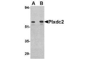 Image no. 1 for anti-Plexin Domain Containing 2 (PLXDC2) (C-Term) antibody (ABIN1492166)