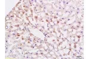 Formalin-fixed and paraffin embedded rat liver labeled with Anti-ABCG5 Polyclonal Antibody, Unconjugated (ABIN708371) at 1:200 followed by conjugation to the secondary antibody and DAB staining. (ABCG5 antibody  (AA 251-350))