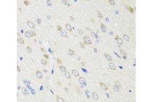 Immunohistochemistry of paraffin-embedded Rat brain using CRABP2 Polyclonal Antibody at dilution of 1:100 (40x lens). (CRABP2 antibody)