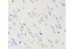 Immunohistochemistry of paraffin-embedded Rat brain using CRABP2 Polyclonal Antibody at dilution of 1:100 (40x lens).