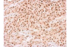 IHC-P Image Rad54B antibody detects RAD54B protein at on SAS xenograft by immunohistochemical analysis. (RAD54B antibody  (C-Term))