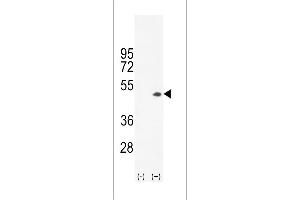 Western blot analysis of CKB (arrow) using rabbit polyclonal CKB- (ABIN391074 and ABIN2841221). (CKB antibody  (C-Term))