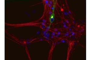 Immunostaining of cultured newborn rat neurons and glia showing peripherin in green and neurofilament L in red.
