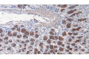 Detection of TNC in Mouse Stomach Tissue using Polyclonal Antibody to Tenascin C (TNC) (TNC antibody  (AA 174-621))