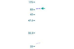 PRKRA Protein (AA 1-313) (GST tag)