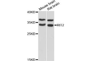 Western blot analysis of extracts of various cell lines, using RIT2 antibody (ABIN6292260) at 1:3000 dilution. (RIT2 antibody)