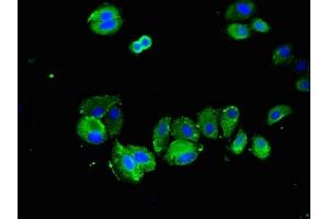 Immunofluorescent analysis of HepG2 cells using ABIN7170654 at dilution of 1:100 and Alexa Fluor 488-congugated AffiniPure Goat Anti-Rabbit IgG(H+L) (SPRY2 antibody  (AA 2-97))