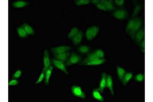 Immunofluorescent analysis of HepG2 cells using ABIN7164982 at dilution of 1:100 and Alexa Fluor 488-congugated AffiniPure Goat Anti-Rabbit IgG(H+L) (PSMB5 antibody  (AA 106-188))