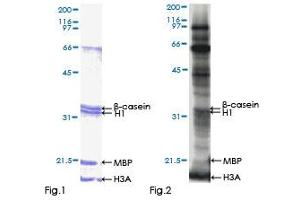 Kinase Activity Assay (KAA) image for Casein Kinase 2, alpha Prime Polypeptide (CSNK2A2) (AA 1-350) protein (GST tag) (ABIN1350553) (CSNK2A2 Protein (AA 1-350) (GST tag))