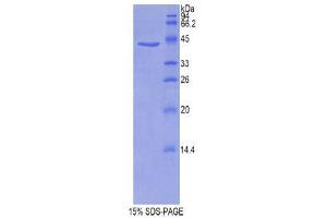 SDS-PAGE (SDS) image for Profilin 1 (PFN1) (AA 2-140) protein (His tag,GST tag) (ABIN2123506) (PFN1 Protein (AA 2-140) (His tag,GST tag))