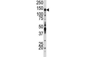 Western blot analysis of IGF1R antibody and SK-BR-3 lysate. (IGF1R antibody  (AA 19-51))