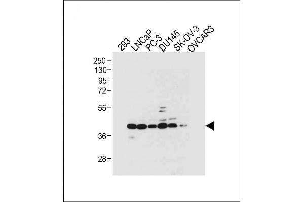STRA8 antibody  (C-Term)