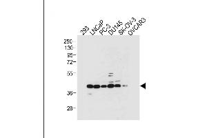 All lanes : Anti-STRA8 Antibody (C-term) at 1:2000 dilution Lane 1: 293 whole cell lysate Lane 2: LNCaP whole cell lysate Lane 3: PC-3 whole cell lysate Lane 4: D whole cell lysate Lane 5: SK-OV-3 whole cell lysate Lane 6: OVCAR3 whole cell lysate Lysates/proteins at 20 μg per lane. (STRA8 antibody  (C-Term))