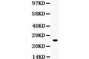 Anti- Picoband antibody, PB, Western blotting All lanes: Anti Kallikrein 4  at 0. (Kallikrein 4 antibody  (AA 31-254))
