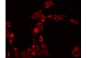 ABIN6274955 staining Hela by IF/ICC. (CHST8 antibody  (C-Term))
