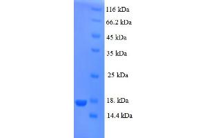 SDS-PAGE (SDS) image for Prolactin-Induced Protein (PIP) (AA 29-146) protein (His tag) (ABIN4974601)