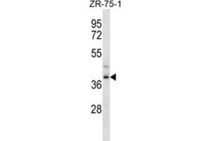 Western Blotting (WB) image for anti-Formyl Peptide Receptor 3 (FPR3) antibody (ABIN2997055) (FPR3 antibody)