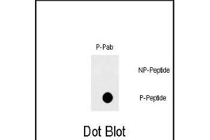 Dot blot analysis of Phospho-FAS- polyclonal antibody (ABIN389708 and ABIN2839663) on nitrocellulose membrane. (FAS antibody  (pTyr291))