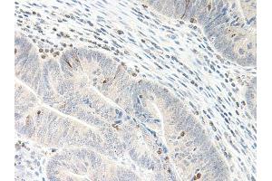 Image no. 1 for anti-Chemokine (C-X-C Motif) Ligand 5 (CXCL5) antibody (ABIN465535) (CXCL5 antibody)