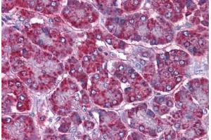 Human Pancreas: Formalin-Fixed, Paraffin-Embedded (FFPE) (SORBS1 antibody  (AA 300-313))