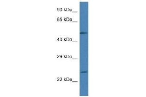 Western Blot showing RAB2A antibody used at a concentration of 1 ug/ml against HepG2 Cell Lysate (RAB2A antibody  (C-Term))