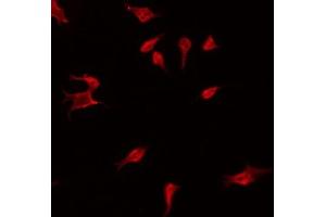 ABIN6275102 staining Hela by IF/ICC. (FBLN4 antibody  (Internal Region))