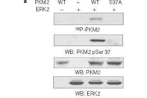 Western blot analysis of in vitro kinase assays carried out with puried active ERK2, wild-type (WT) PKM2 and PKM2 S37A mutant using PKM2(phospho-Ser37)Antibody. (PKM antibody  (pSer37))
