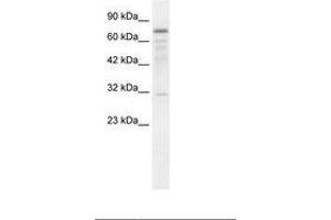 Image no. 1 for anti-tRNA Methyltransferase 1 (TRMT1) (AA 418-467) antibody (ABIN202857) (TRMT1 antibody  (AA 418-467))