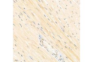 Immunohistochemistry of paraffin embedded rat heart using Arhgap17 (ABIN7075416) at dilution of 1: 700 (400x lens) (ARHGAP17 antibody)