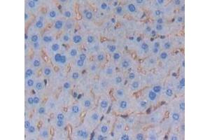 IHC-P analysis of Mouse Tissue, with DAB staining. (TREM1 antibody  (AA 21-230))