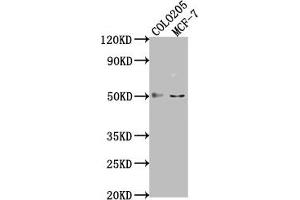 Western Blot Positive WB detected in: COLO205 whole cell lysate, MCF-7 whole cell lysate All lanes: LRAT antibody at 1:2000 Secondary Goat polyclonal to rabbit IgG at 1/50000 dilution Predicted band size: 26 kDa Observed band size: 50 kDa (LRAT antibody  (AA 24-182))
