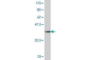 Western Blot detection against Immunogen (38. (USP5 antibody  (AA 71-180))